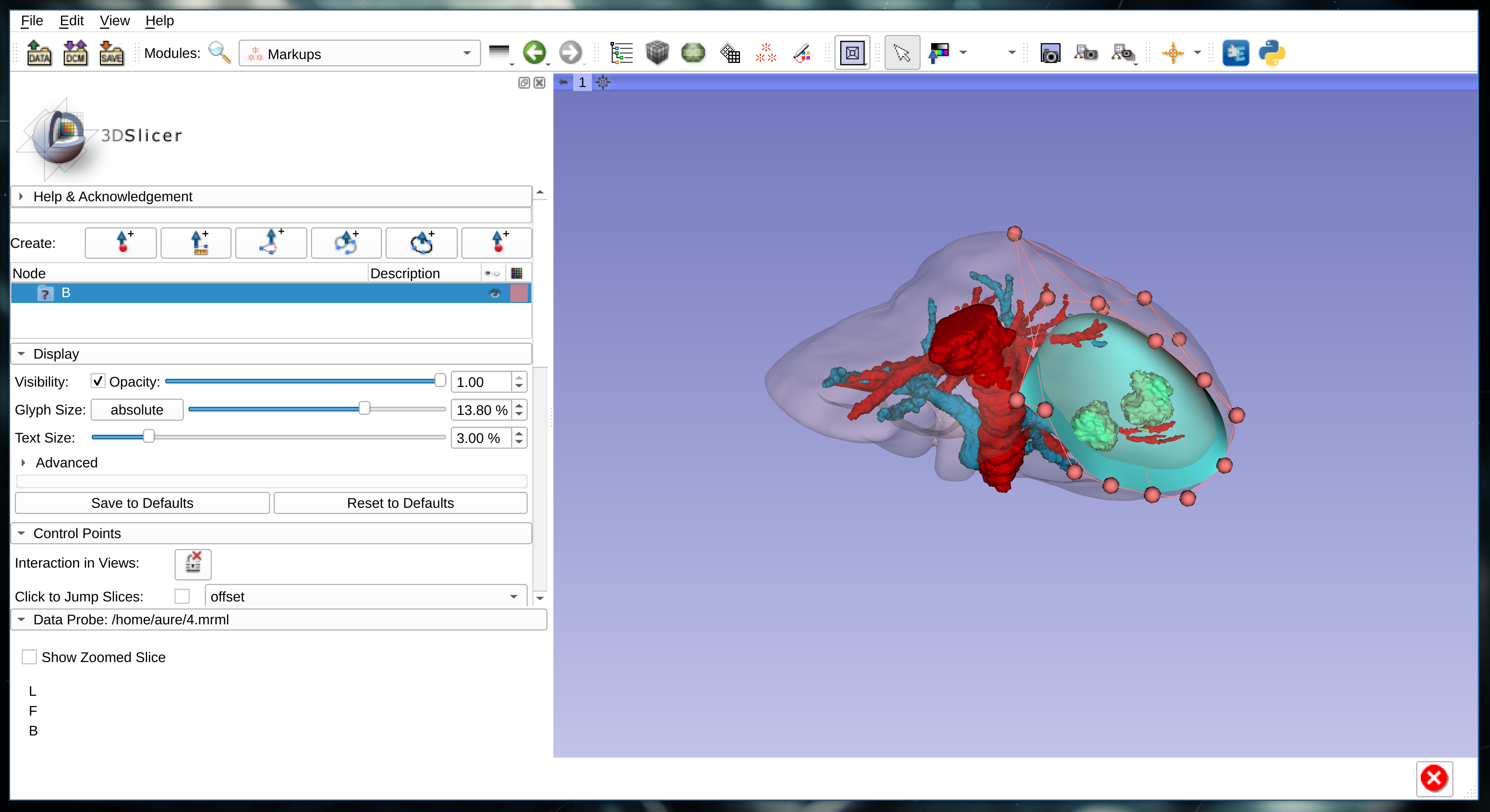 3D Bezier Surface Markup